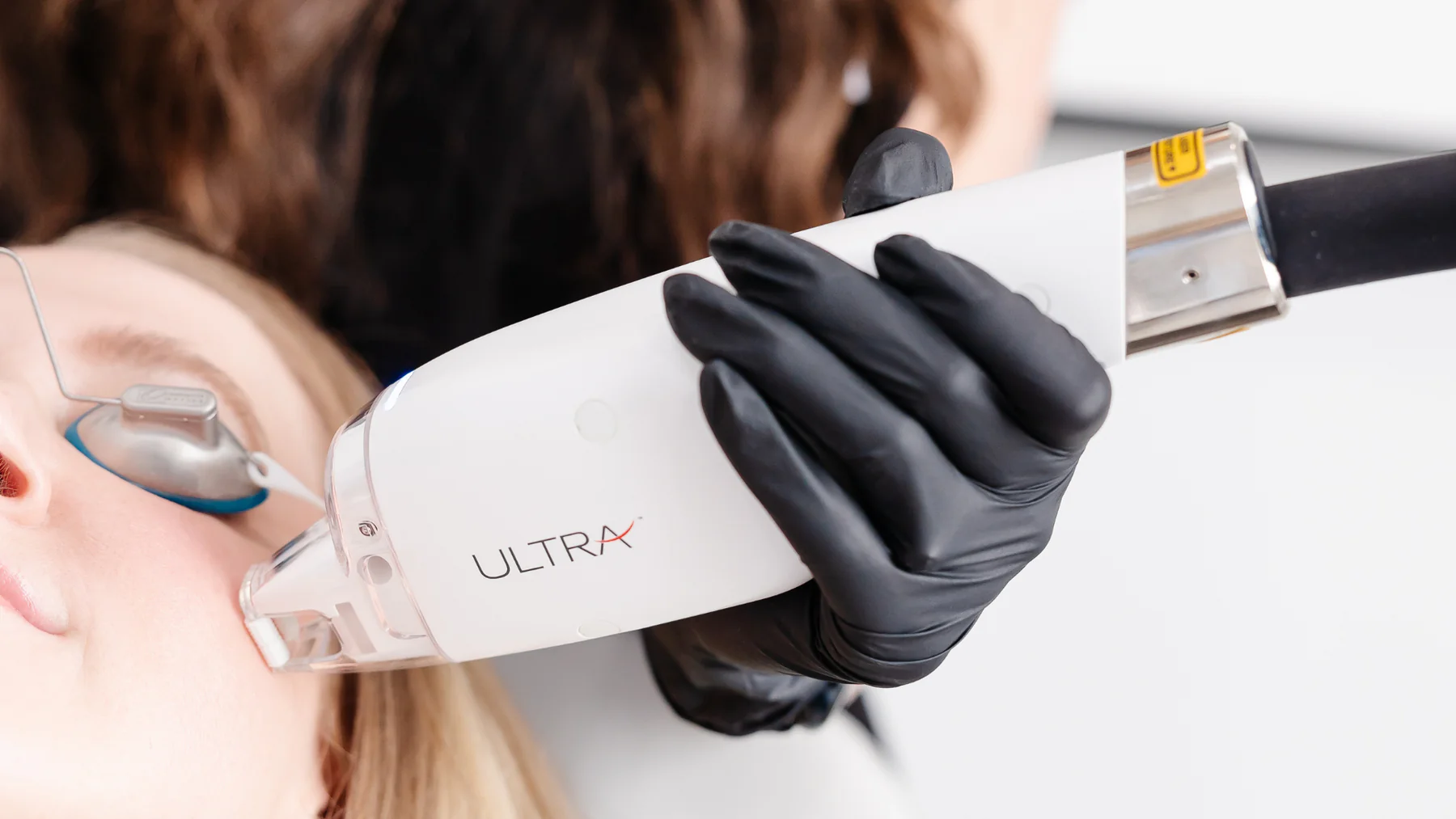 LaseMD Ultra Treatment